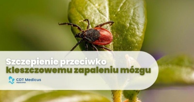 Szczepienie przeciwko kleszczowemu zapaleniu mózgu w CDT Medicus 