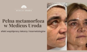 Pełna metamorfoza w Medicus Uroda – efekt współpracy lekarzy i kosmetologów