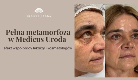 Pełna metamorfoza w Medicus Uroda – efekt współpracy lekarzy i kosmetologów