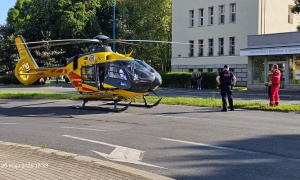 14-latek z ciężkimi oparzeniami