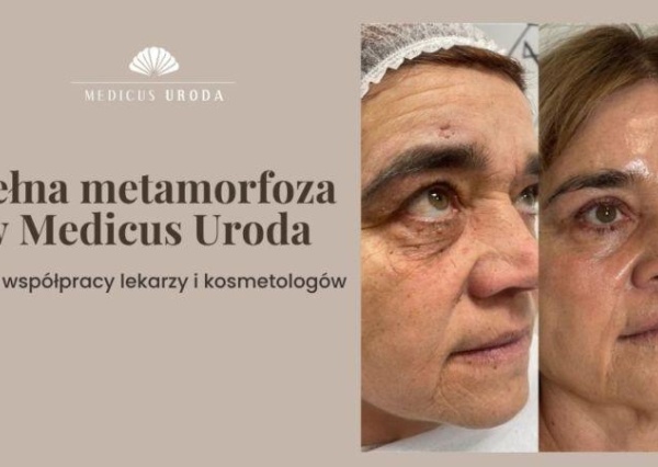 Pełna metamorfoza w Medicus Uroda – efekt współpracy lekarzy i kosmetologów