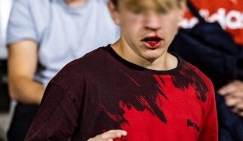 Mamy oświadczenie Miedzi po skandalu na stadionie w Legnicy w piątkowy wieczór