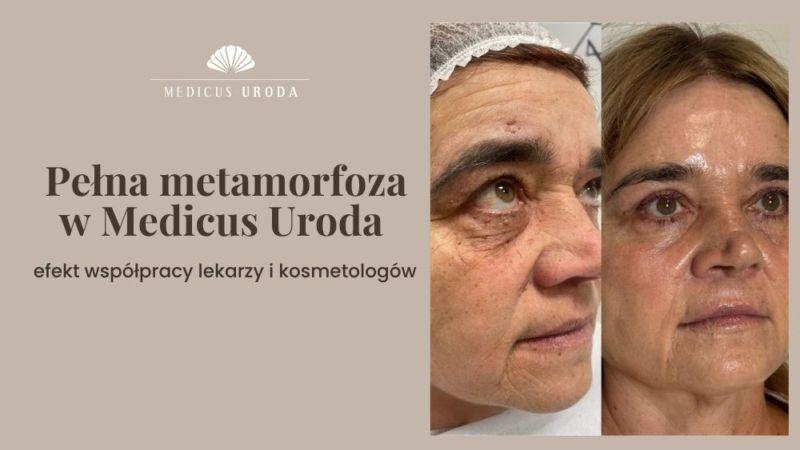 Pełna metamorfoza w Medicus Uroda – efekt współpracy lekarzy i kosmetologów